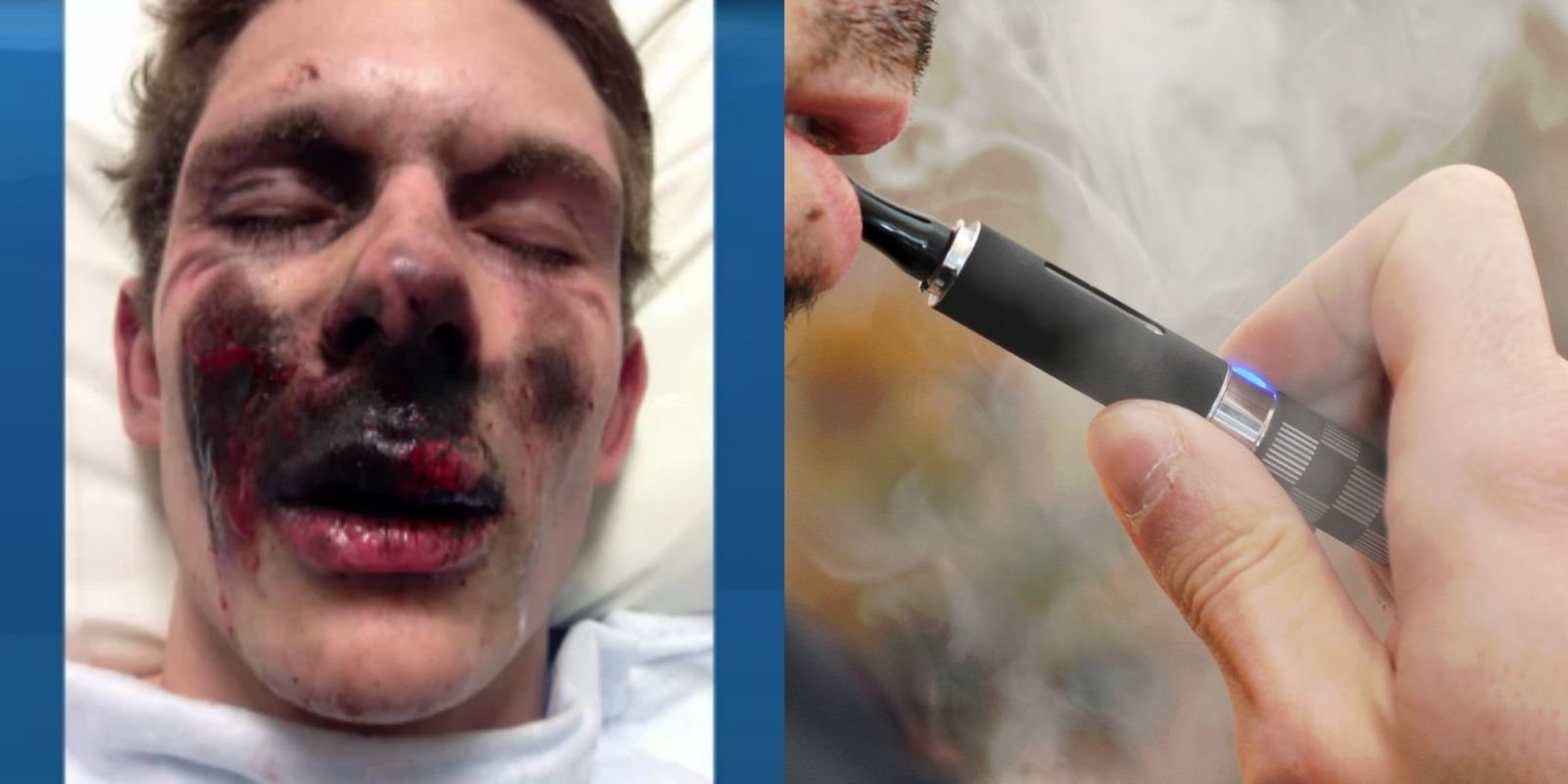 landscape-1454038840-e-cigarette-explosion-photos.jpg