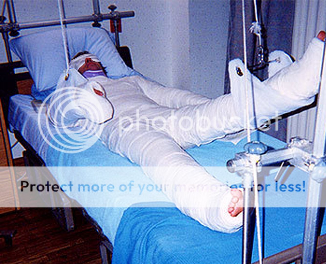 full-body-cast_zps015cdcef.jpg