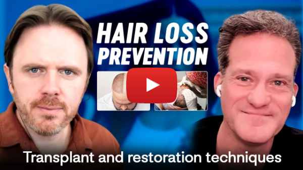 Dr. Alan Bauman - Hair loss prevention, hair transplants and hair restoration techniques