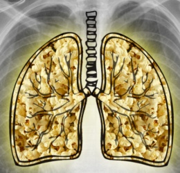 about-diacetyl-popcorn-lung.jpg