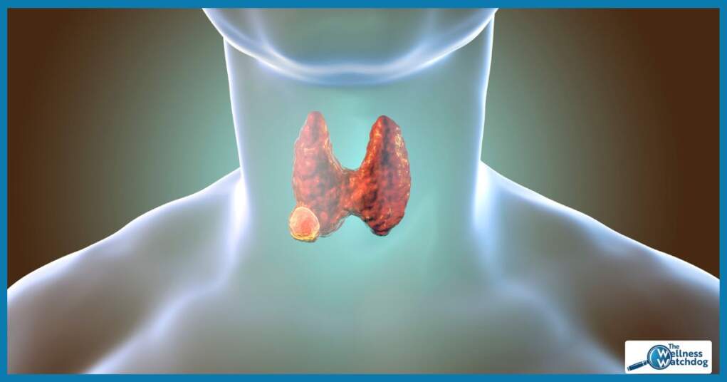 thewellnesswatchdog.com