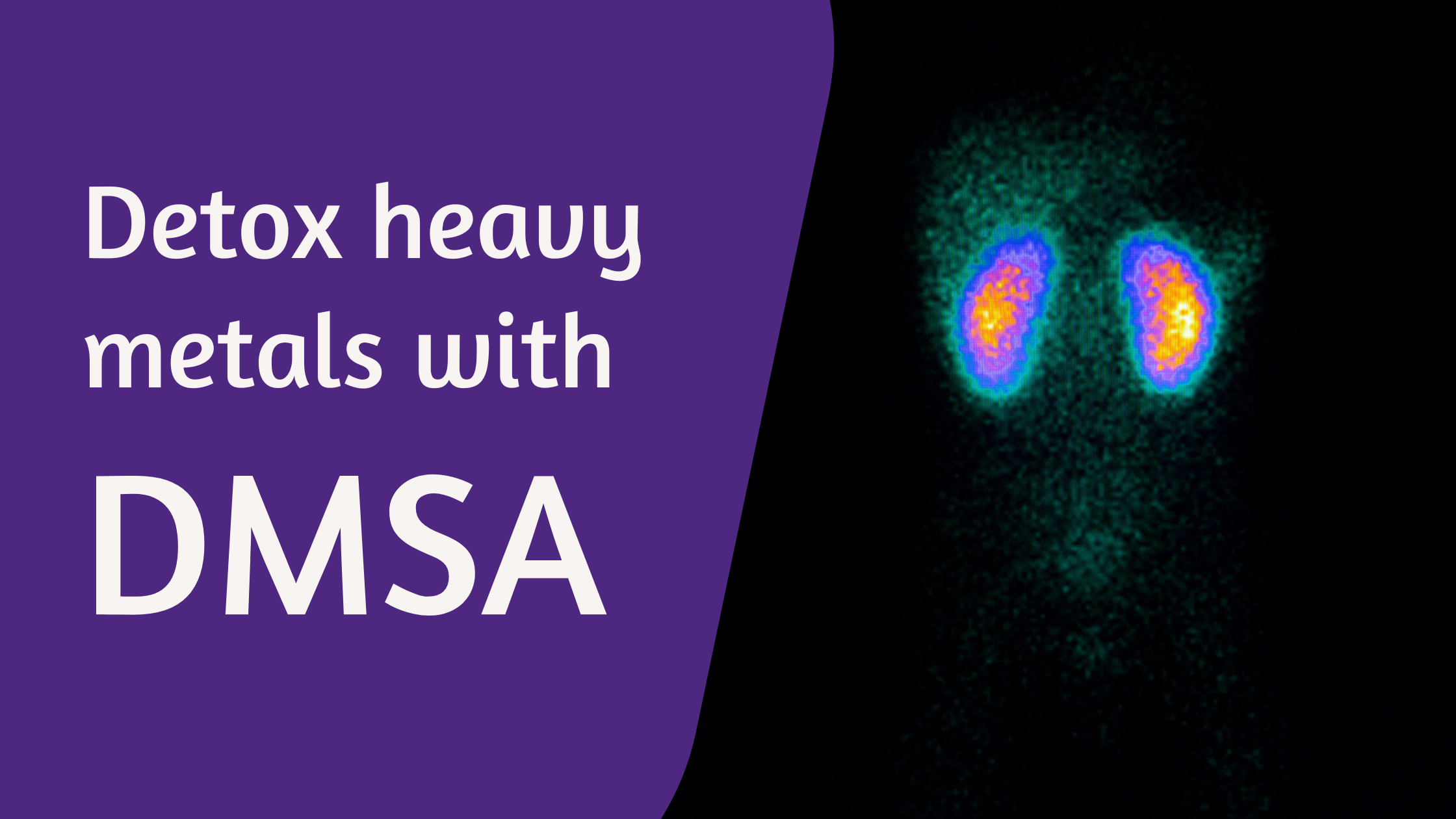 breastcancerconqueror.com