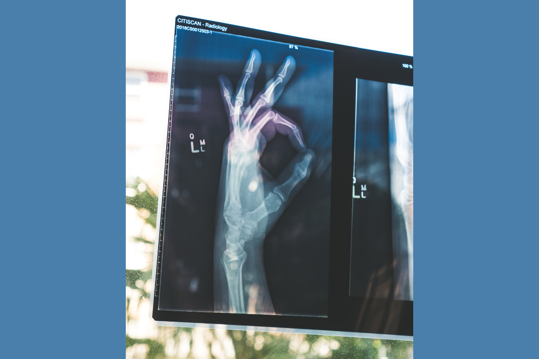 soliscancercommunity.com