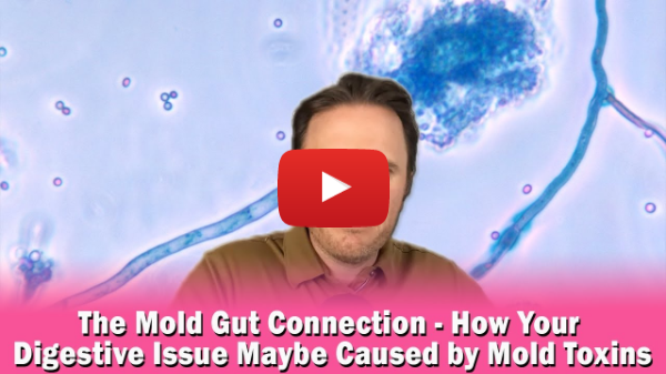 The Mold Gut Connection - How Your Digestive Issue Maybe Caused by Mold Toxins | Podcast #371